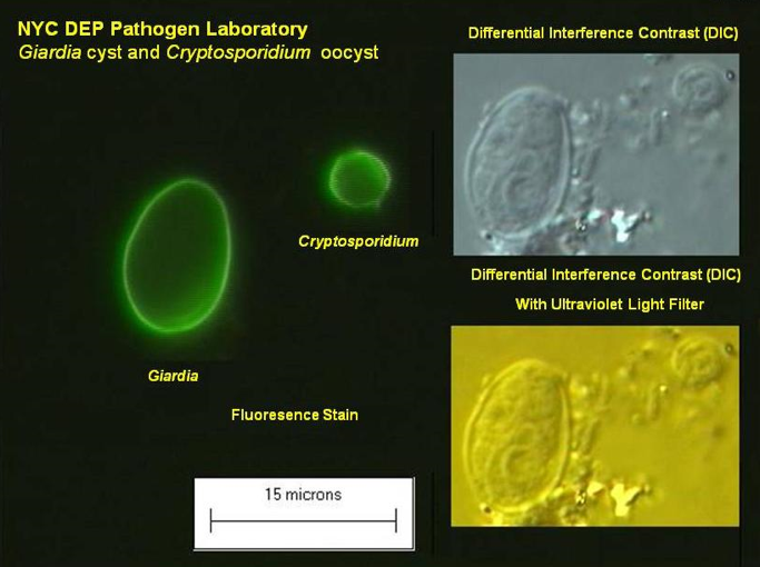 Giardia protozoan parasite, Cryptosporidium and giardia parasites